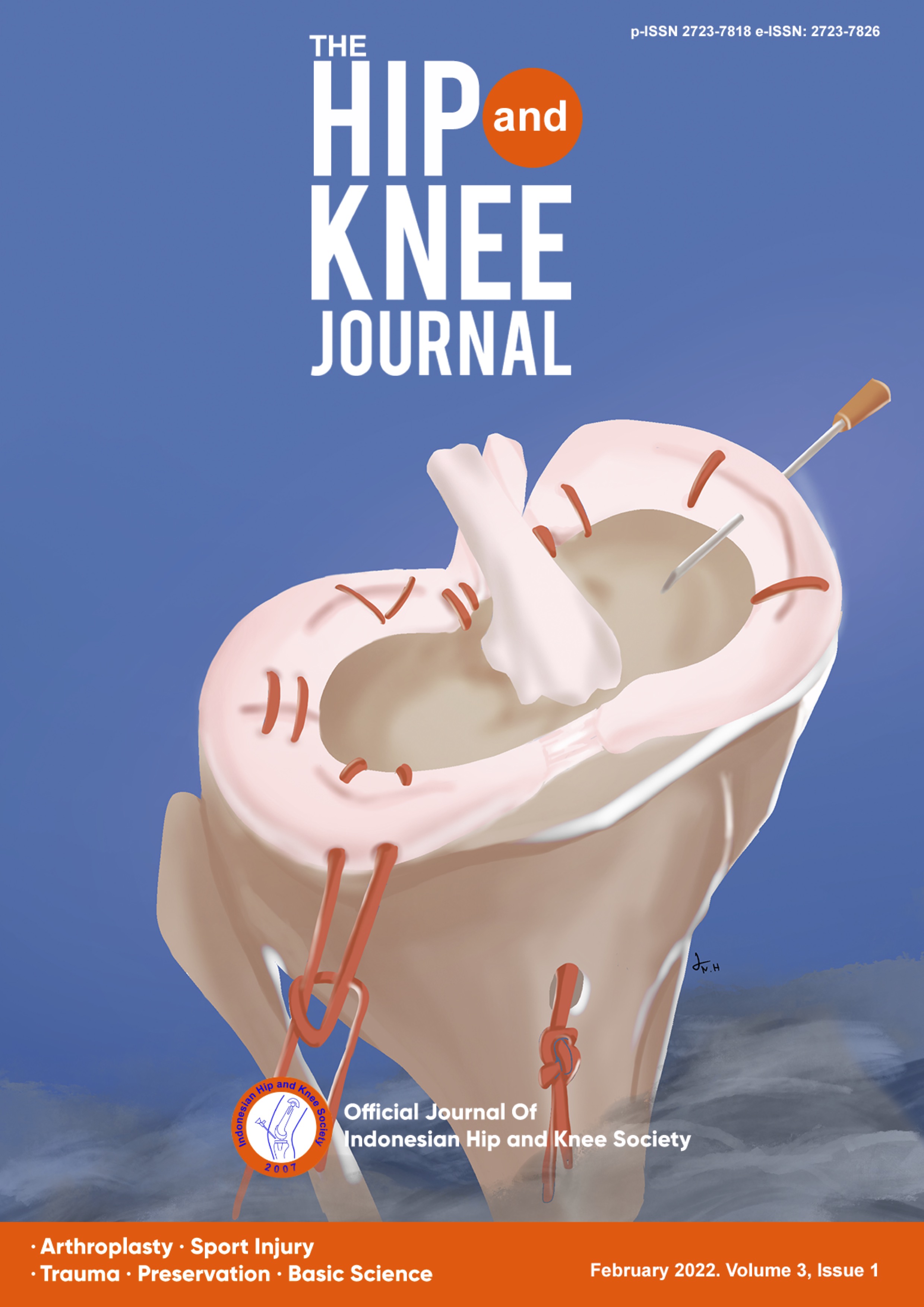 Save The Meniscus